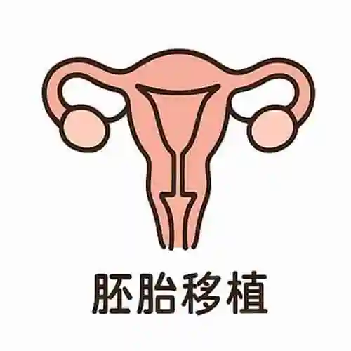 美国试管婴儿