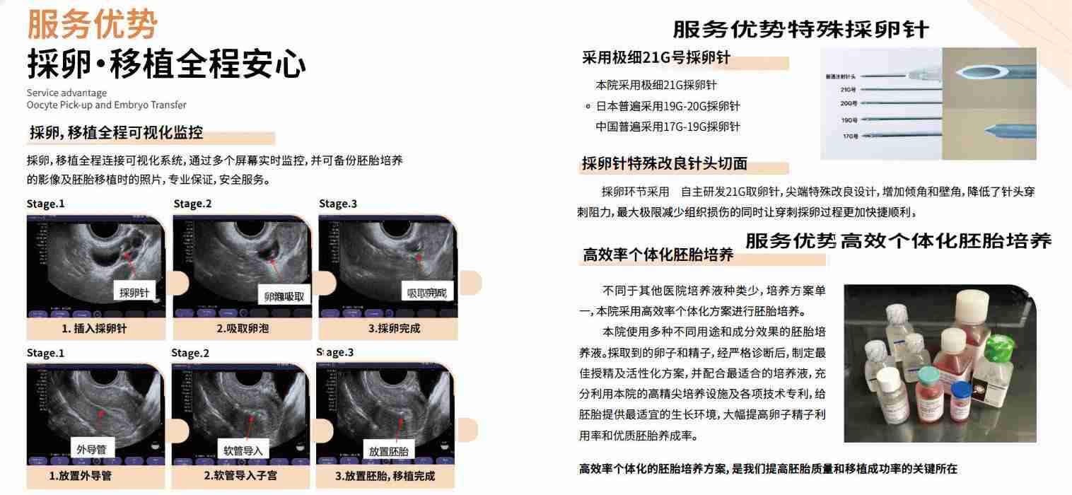 日本试管婴儿