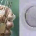 捐卵捐精