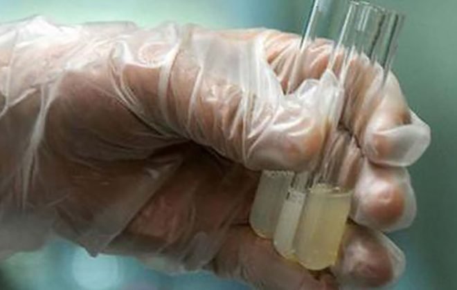 精子洗涤技术介绍！